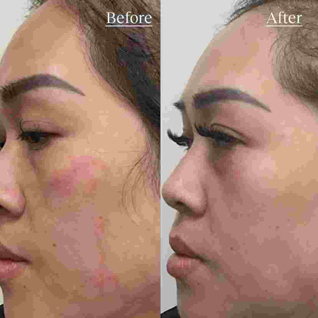 SKIN.jpg